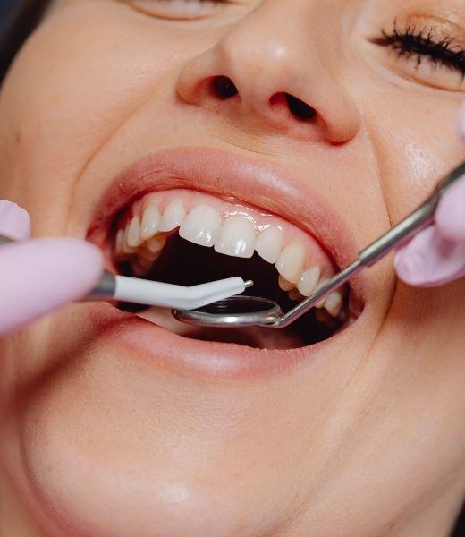 Close-up gebitscontrole bij Mondhygiënist Elles in Assen